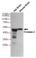 Anti-Enolase-2 Antibody