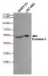 Anti-Enolase-2 Antibody