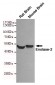 Anti-Enolase-2 Antibody