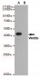 Anti-Wnt5b Antibody