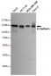 Anti-E-Cadherin Antibody