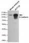 Anti-E-Cadherin Antibody