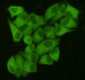 Anti-Fatty Acid Synthase Antibody