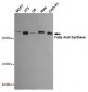 Anti-Fatty Acid Synthase Antibody