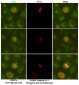 Anti-SirT2 Antibody