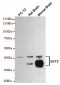 Anti-SirT2 Antibody