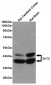 Anti-SirT2 Antibody