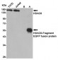 Anti-HDAC6 Antibody