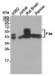 Anti-Fas Antibody