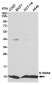 Anti-S100A6 Antibody