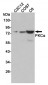 Anti-PKCa antibody