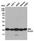 Anti-SOD2 Antibody