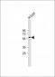 PPARG Antibody (N-term)