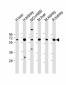 PCK1 Antibody (C-term)