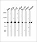 SCAP Antibody (Center)