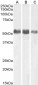 Anti-ALPL Antibody (Internal) (aa42-53)