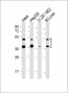 FDPS Antibody (Center)