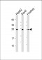 HAVCR2 Antibody