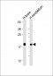 VILIP1 Antibody