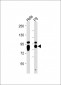 ALPL Antibody (Center)