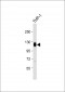 THBD Antibody (N-Term)