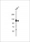 THBD Antibody (C-Term)