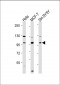 VAV2 Antibody (N-Term)