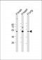 CX3CL1 Antibody (Center)