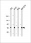 TAK1 (Ser439) Antibody