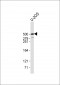 PLEC Antibody (C-Term)