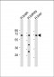 SLC7A8 Antibody (C-Term)