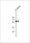 GGT3P Antibody (Center)