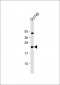 IL11 Antibody (N-Term)