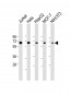 PSMD3 Antibody (C-Term)