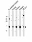 FABP4 Antibody (Y20)