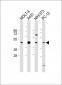 ASS Antibody (Center)