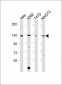 ROR2 Antibody (C-term)