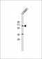 TXK Antibody (N-term)