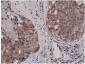 Anti-Akt1 Rabbit Monoclonal Antibody 