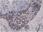 Anti-phospho-Akt (Ser473) Rabbit Monoclonal Antibody