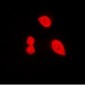 Phospho-DDX3X (Thr322) Antibody