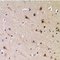 Phospho-DDX3X (Thr322) Antibody