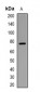 Phospho-DDX3X (Thr322) Antibody