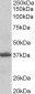 Goat Anti-AIMP1 / SCYE1 Antibody (aa137-149) (internal region), Biotinylated