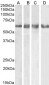Goat Anti-GABRG2 Antibody (aa384-396) (internal region)