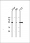 RBCK1 (UBCE7IP3) Antibody