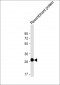 ROS1 Antibody