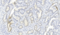 ROS1 Antibody