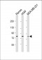 TLR2 Antibody