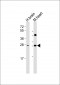 DKK2 Antibody